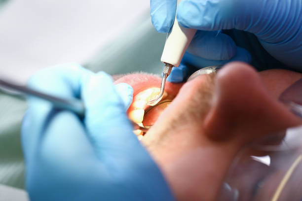 Best Emergency Tooth Extraction in Brooklyn Heights, OH