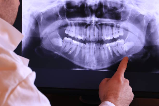 Best Emergency TMJ Treatment in Brooklyn Heights, OH