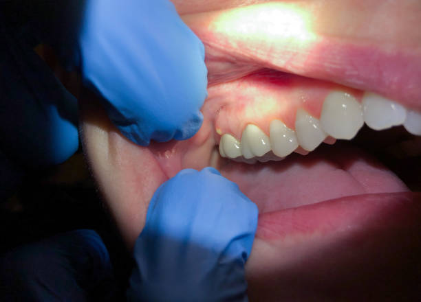 Best Urgent Care for Lost Fillings or Crowns in Brooklyn Heights, OH