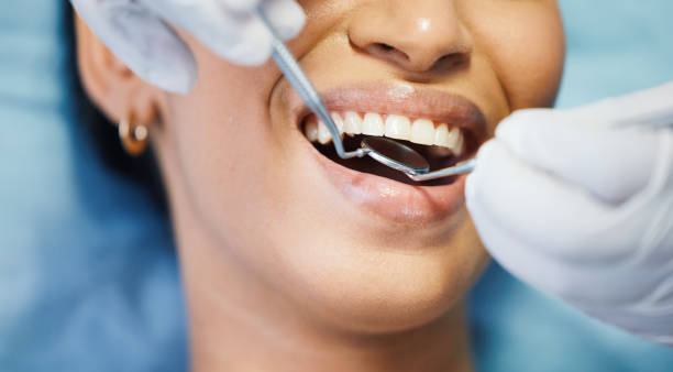 Best Emergency Dental Care for Broken or Chipped Teeth in Brooklyn Heights, OH